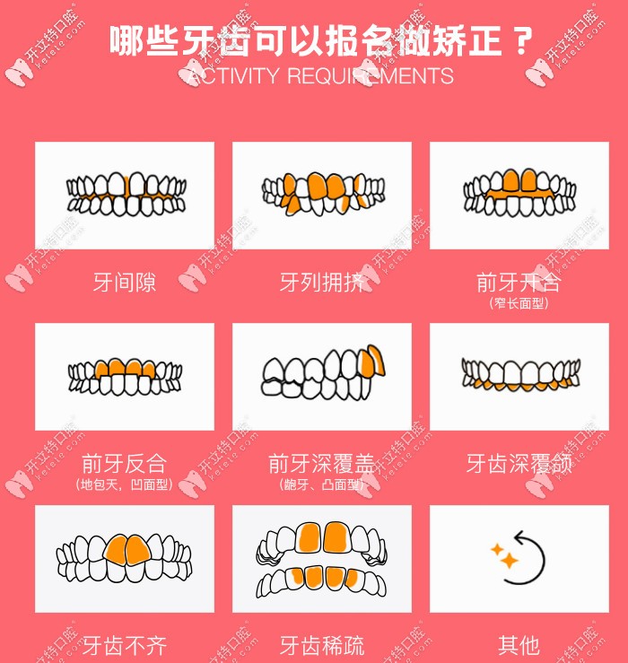 告訴你哪些牙齒可以報名做矯正