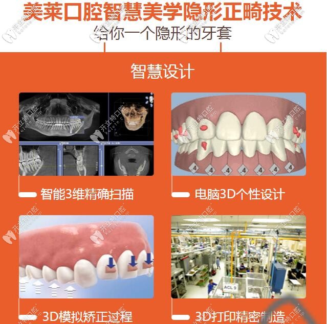 深圳美萊口腔美學(xué)正畸技術(shù)
