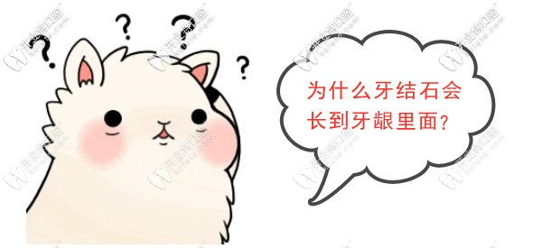 為什么牙結(jié)石會長到牙齦里面？