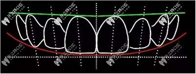DSD美學(xué)修復(fù) DSD美學(xué)修復(fù)