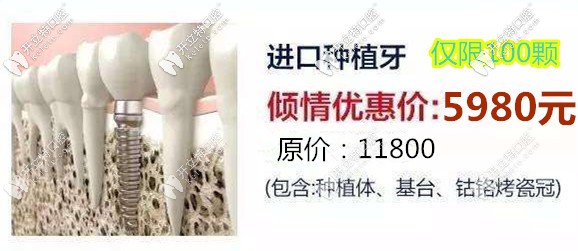 請(qǐng)看在濟(jì)南做韓國(guó)奧齒泰種植牙多少錢一顆