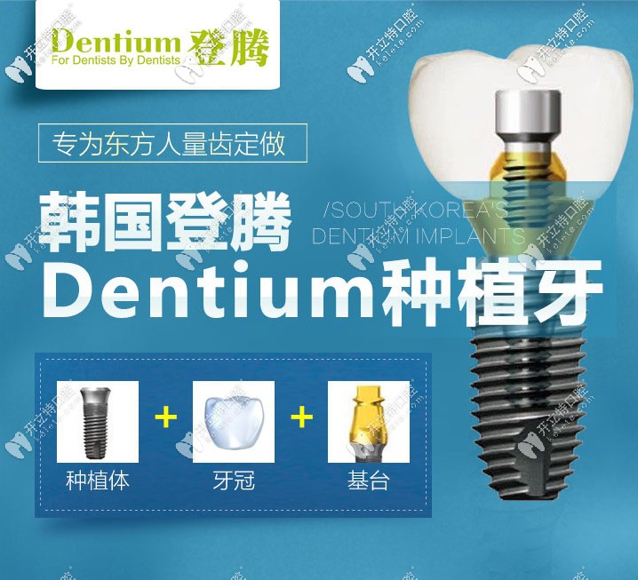 南京做韓國登騰種植牙多少錢？它的使用壽命有多長呢？