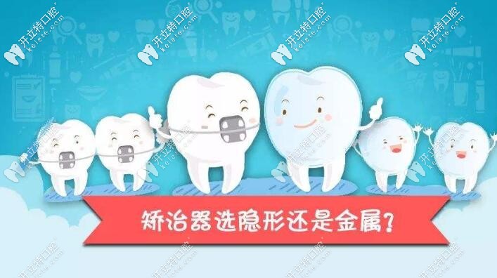 金屬自鎖和隱形矯正哪個(gè)好