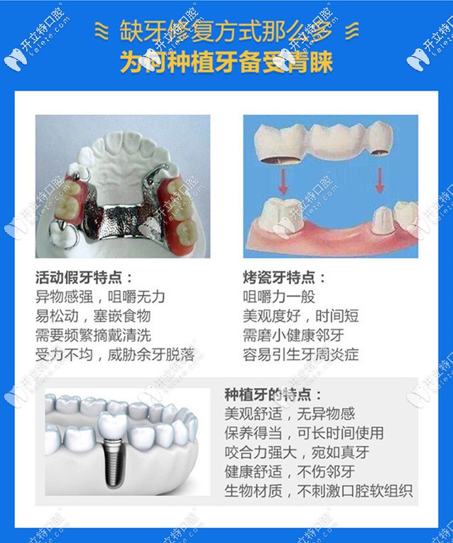 誰有成都圣貝牙科醫(yī)院種植牙價格表?聽說費(fèi)用不是很高哦!