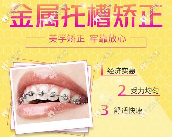 深圳希奧口腔金屬托槽牙齒矯正 深圳希奧口腔金屬托槽牙齒矯正