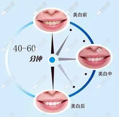 冷光美白維持時間