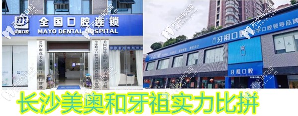都是連鎖牙科長沙牙祖和美奧到底哪個好?