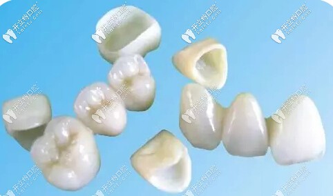 全瓷牙修復(fù)