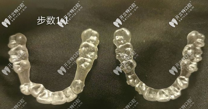 剛拿到的牙套和兩年后的牙套對(duì)比