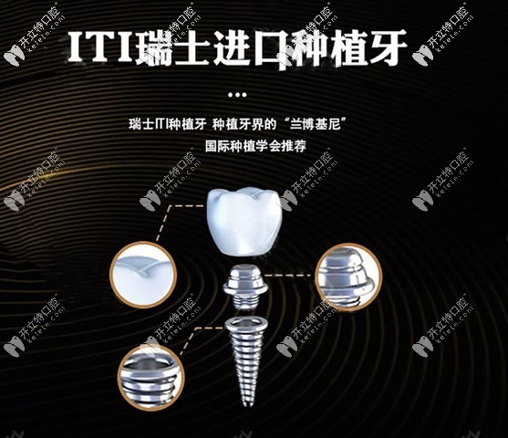 瑞士iti種植體又叫Straumann種植系統(tǒng)