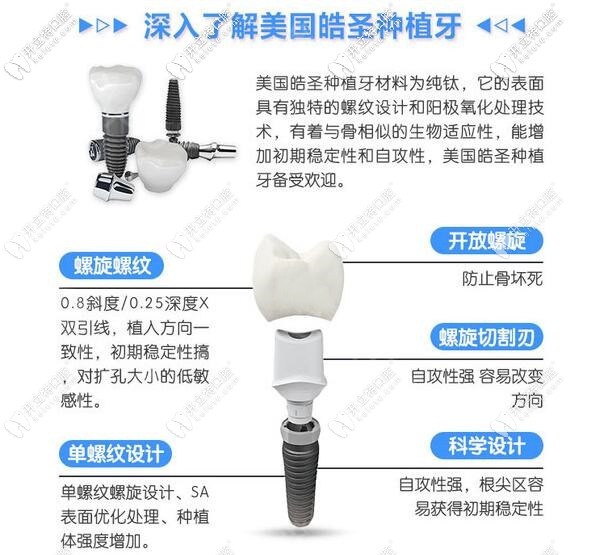 深圳弘和口腔美國皓圣種植牙怎么樣