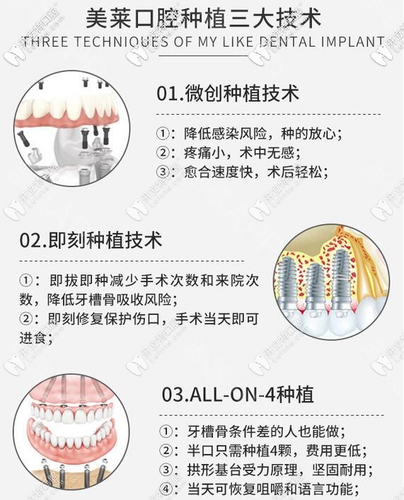 深圳美萊口腔3大種植牙技術(shù) 深圳美萊口腔3大種植牙技術(shù)