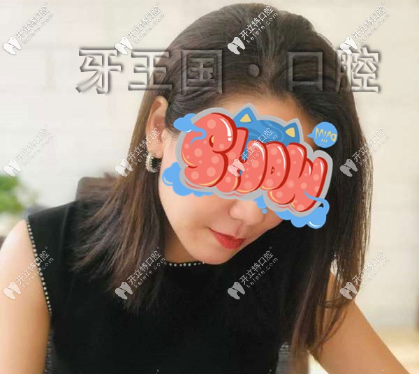 牙齒矯正后變化