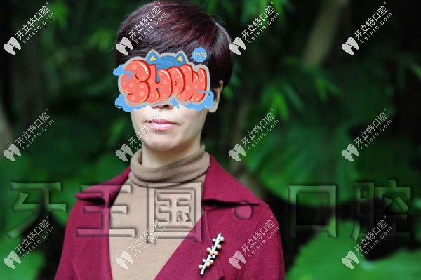 牙齒前突矯正前