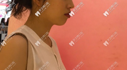 一個月后 一個月后