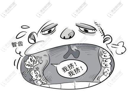 智齒拔除也需要分情況