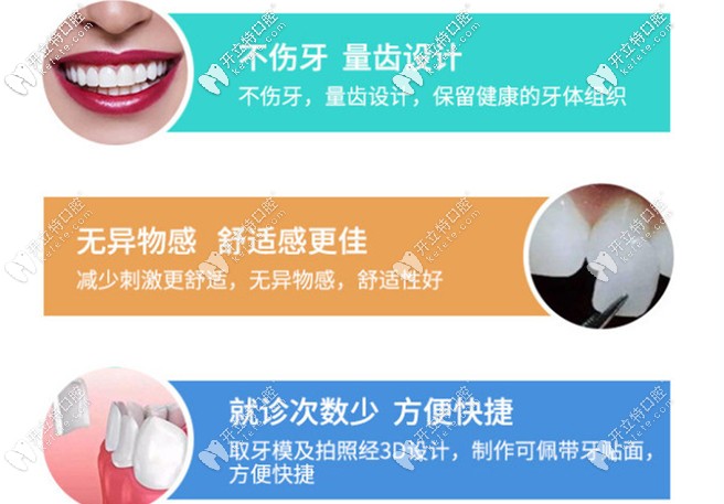 牙齒貼面的優(yōu)勢 牙齒貼面的優(yōu)勢