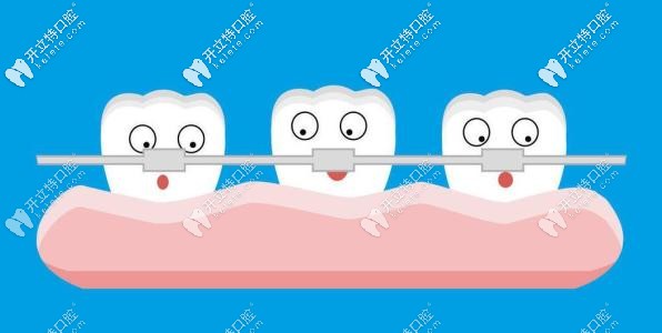 牙齒矯正是不可逆的 牙齒矯正是不可逆的