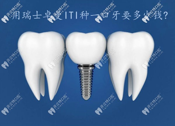 在西安用瑞士ITI種一口牙的價錢是多少?全口種植費用上線咯