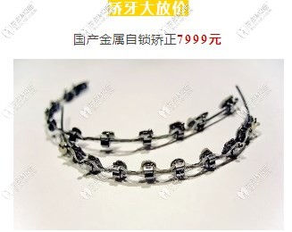 金屬自鎖托槽價(jià)格