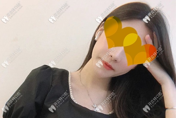 吳小姐做完正頜術(shù)后3個月圖