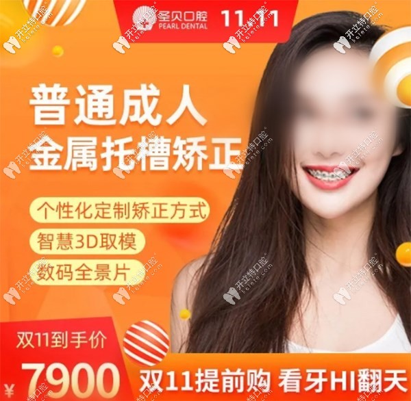 經(jīng)典金屬托槽矯正