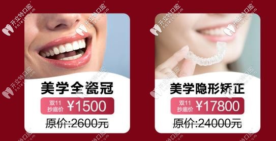 金鉑利口腔牙齒矯正價格