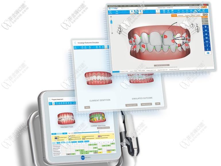 口掃黑科技展示