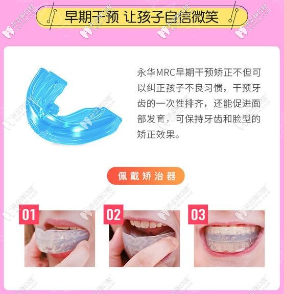 什么是MAC兒童早期矯正器