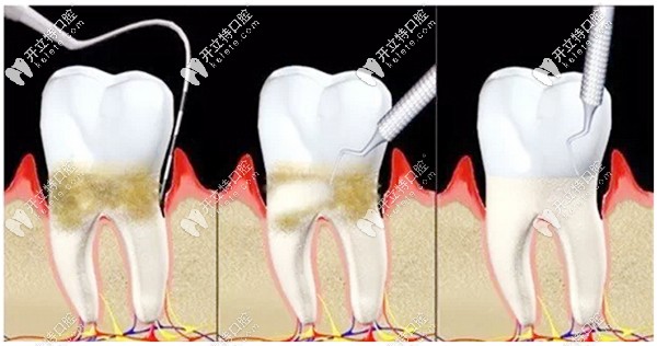 胡鑫醫(yī)生的個人簡介