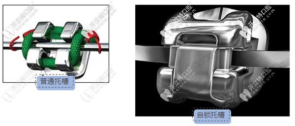 美國(guó)奧美科damon Q自鎖托槽