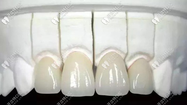 王旭醫(yī)生的擅長(zhǎng)項(xiàng)目介紹