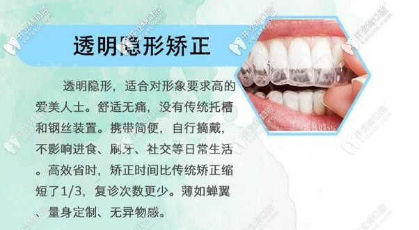 全隱形牙套優(yōu)勢 全隱形牙套優(yōu)勢