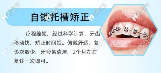 金屬自鎖牙套矯正器優(yōu)勢 金屬自鎖牙套矯正器優(yōu)勢