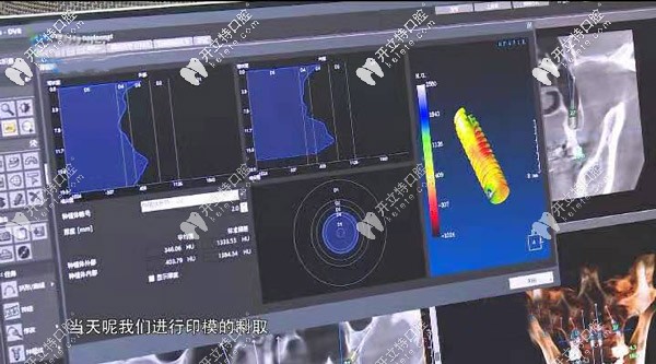 當(dāng)天就可完成取模制作