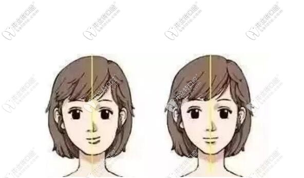 骨性牙齒偏頜大小臉