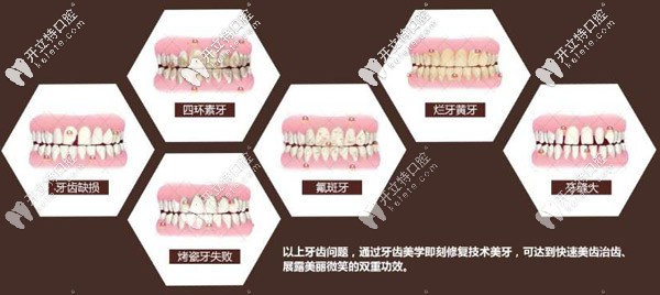 需要做修復(fù)的牙齒情況 需要做修復(fù)的牙齒情況