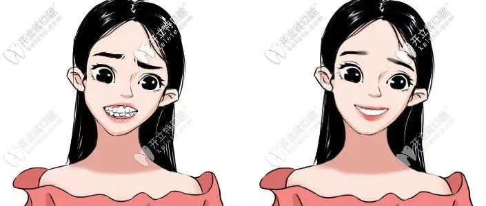 整完牙都變漂亮了呢！