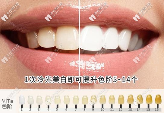 湘潭牙科醫(yī)院洗牙