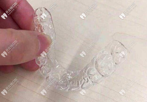  溫州做隱形的牙齒矯正多少錢?透明牙套不僅好看收費也不貴