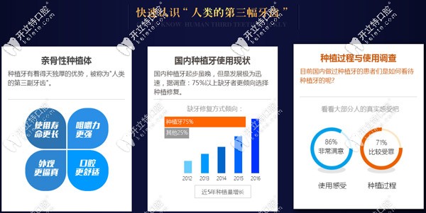 圣貝齒科三大種植技術(shù)