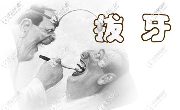 棗莊拔牙價(jià)格一覽表