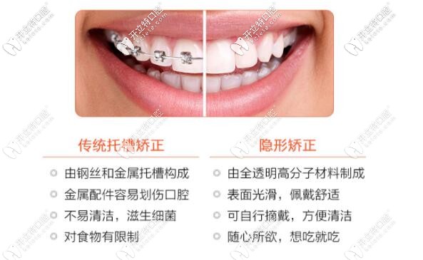 傳統(tǒng)矯正和隱形矯正的區(qū)別