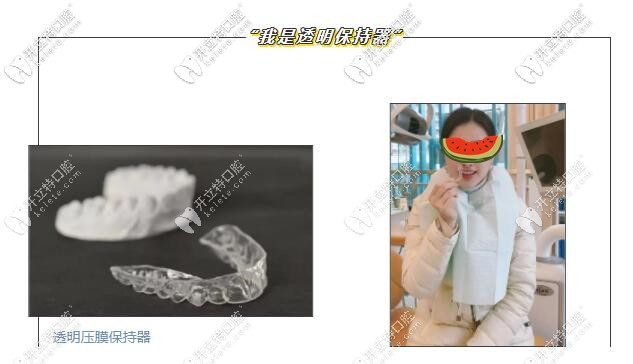 壓膜保持器的圖片