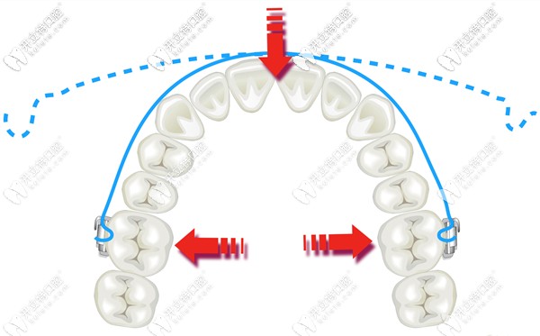 這份口腔正畸弓絲的種類及性能還挺全面嘛！