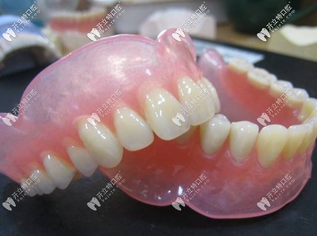 全口活動(dòng)假牙圖示 全口活動(dòng)假牙圖示