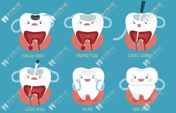 聽(tīng)說(shuō)牙疼會(huì)引起發(fā)燒,那牙痛發(fā)燒該如何處理呢？