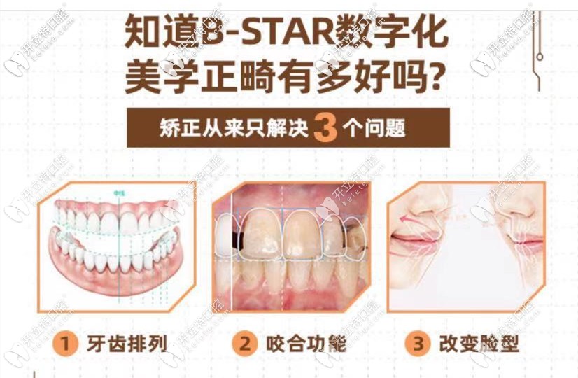 數(shù)字化矯正優(yōu)勢