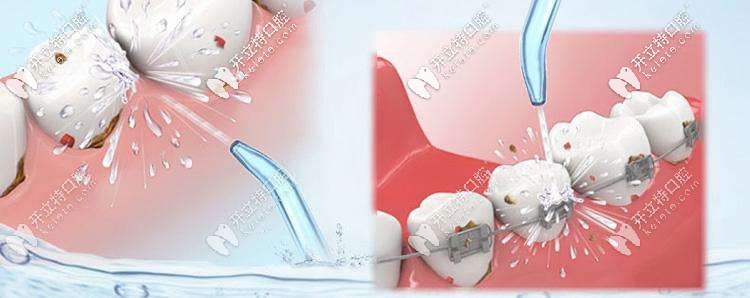 半年洗一次牙，保持牙齒健康