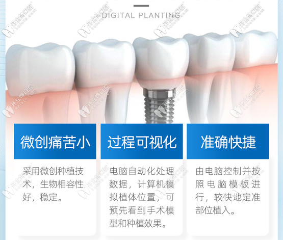 種植牙的優(yōu)勢